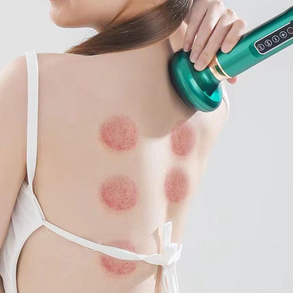 Masażer Ciała 12 Poziomów Masażer Antycellulitowy Ogrzewanie Podciśnieniowe Urządzenie do Skrobania Odpowiednie na Plecy i Nogi