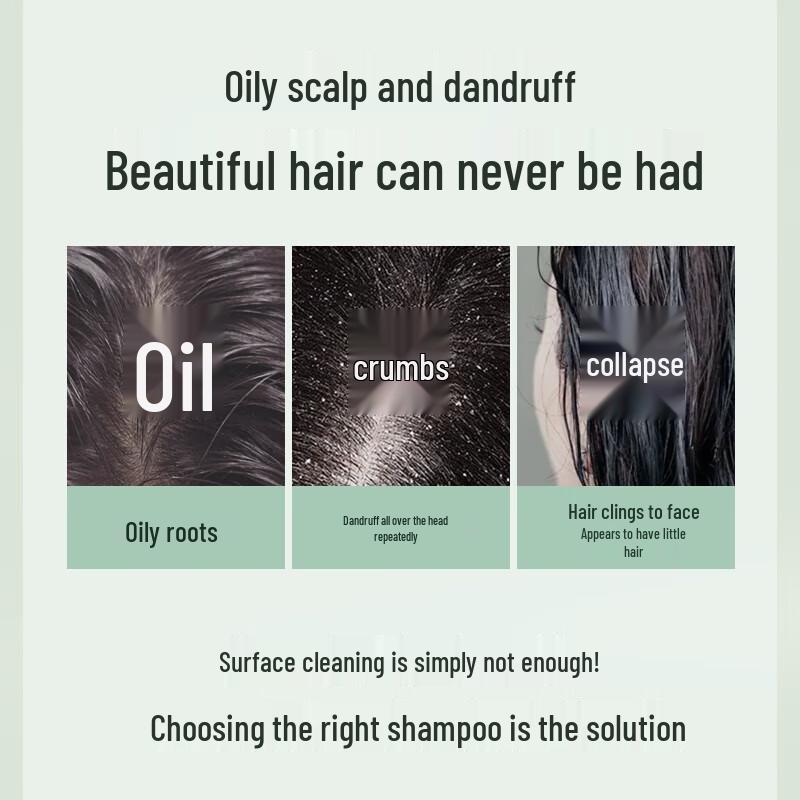 Selsun Blue Tea Tree Anti-Dandruff Oil Control Volumizing Shampoo Set