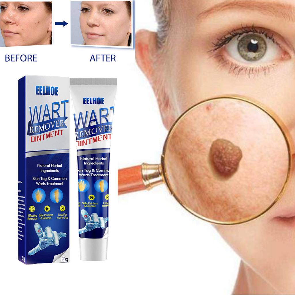 Hautglättende Pflegecreme Verbessert den Hautzustand Feuchtigkeitsspendende Pflege Narbenmildernde Narbenentfernungs-Pflegecreme