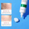 BIOAOUA Salicylic Acid Acne Cream Shrink Pore Cream Elimination Large Pores Remove Blackehead Repairing Skin Care Facial Cream