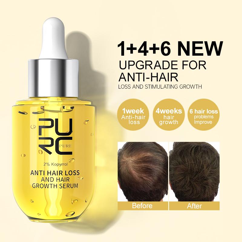 PURC Ginger Hair Growth Serum for Men Women - Hair Regrowth Thicken Thinning Hair Loss Treatment Hair Care