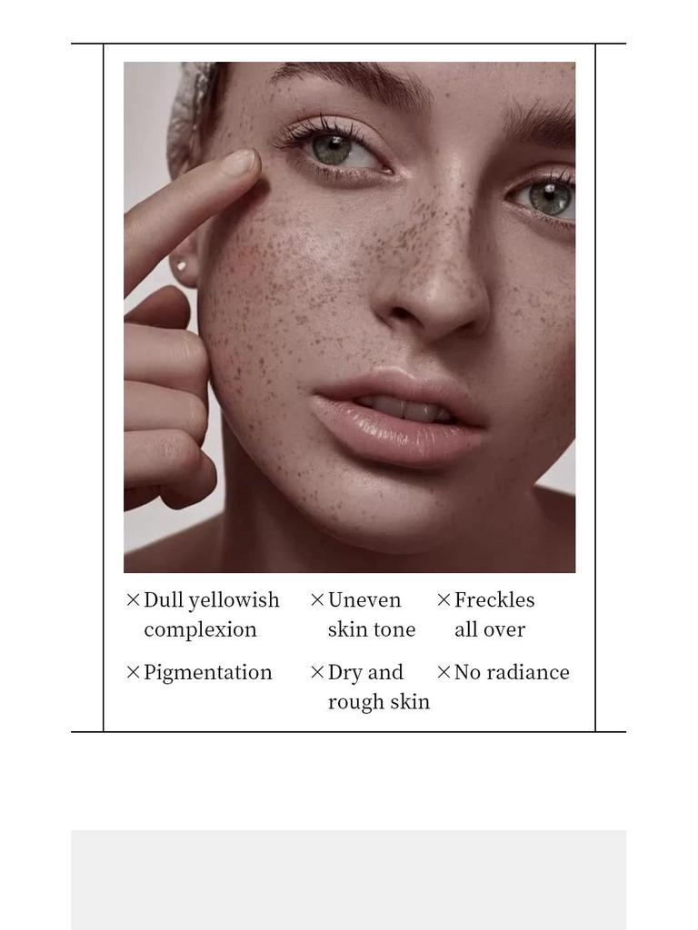 Niacinamide Whitening & Spot-Removing Face Cream: Skin Brightening & Repair