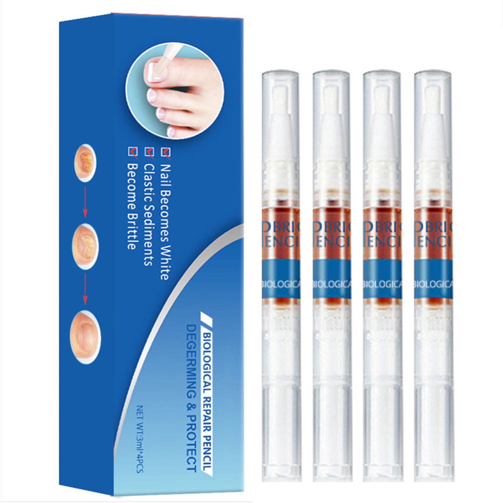 

Лечение грибка ногтей на ногах, средство для ухода за ногтями, средство для ухода за толстыми, обесцвеченными и поврежденными ногтями, 3 мл One Size