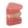 Dental Orthodontic Model 28pcs Teeth Resin Dental Teaching Teeth Model with Metal Braces
