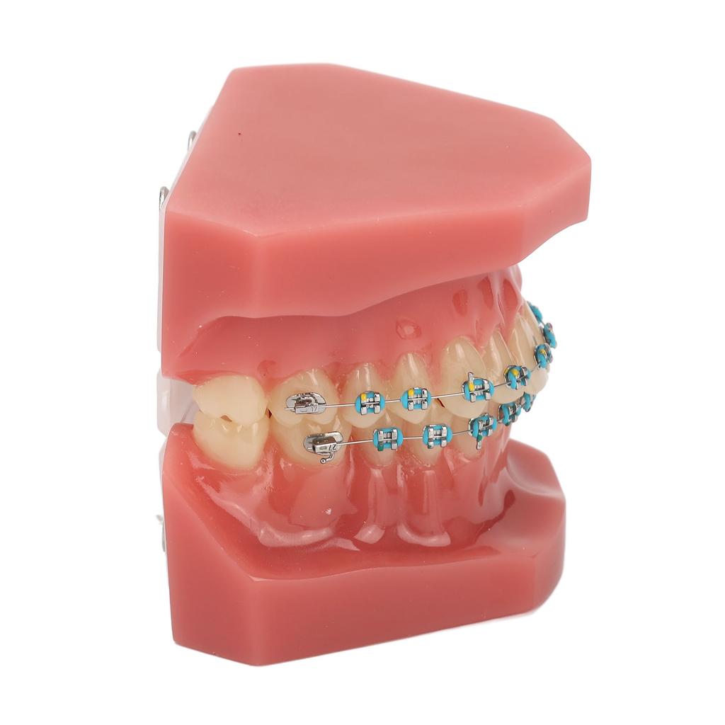 Dental Orthodontic Model 28pcs Teeth Resin Dental Teaching Teeth Model with Metal Braces