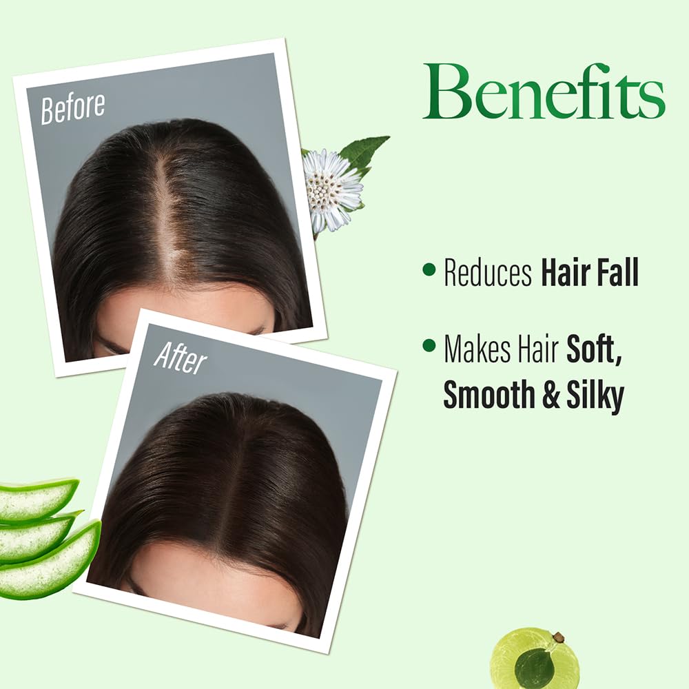 Kesh King Anti Hairfall Shampoo with aloe and 21 herbs, 340ml
