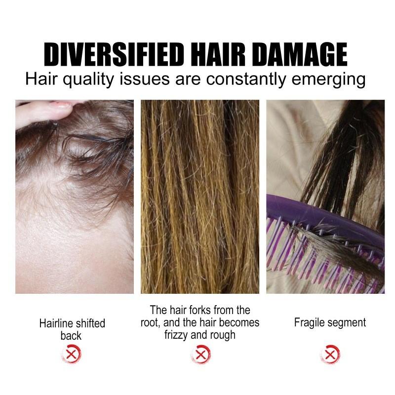 Eelhoe Nourishing Rosehip Oil For Hair Moisturizing And Strengthening 30ml Bottle