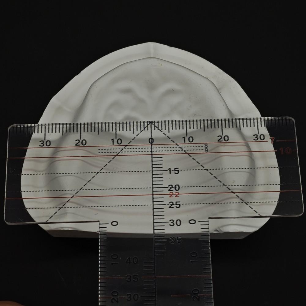 Стоматологическая лаборатория Стоматологическая направляющая пластина Расположение зубов — фото 7
