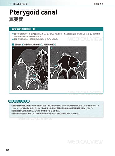 Canal Foramen, Fissure, Space & Membrane: Topographical Anatomy and Image Diagnosis for Interpretation