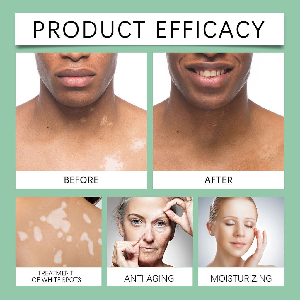 Ximonth Skin Repair Cream For Ultimate Hydration Nourishing Moisturizing Body Care