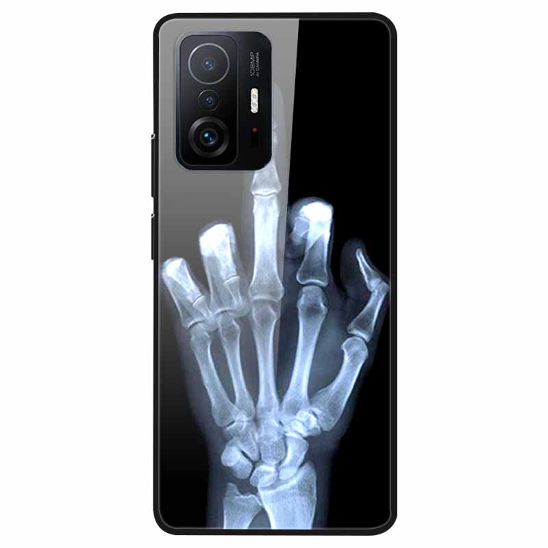 Tempered Glass Case For Xiaomi 11T Cover 6.67 Cool Bumper Hard glass Case For Xiaomi 11T Pro Case Mi 11T Pro Mi11T Capa Shells