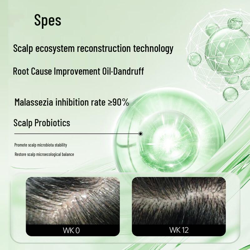 Spes Red Ginseng & Ginger Scalp Care Shampoo