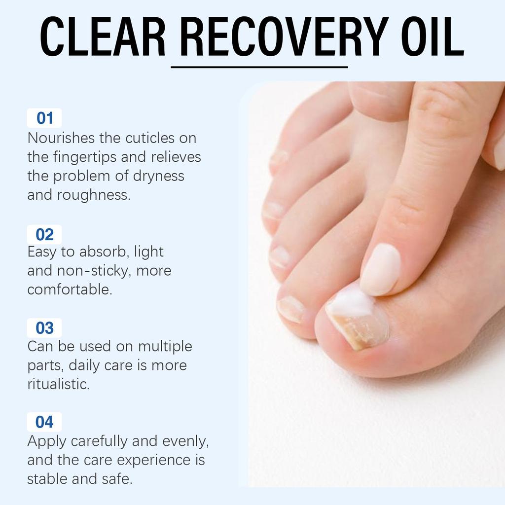 Nail Oil Nutrient Solution Nail Care Nail Care Oil Nail Strengthening Cuticle 30ml