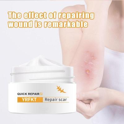 Scar Removal Cream Scar Repair Cream Scar Removal And Skin Repair
