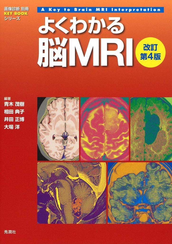 Easy-to-understand Brain MRI, Revised 4th Edition (Image Diagnosis Special Edition KEY BOOK Series)