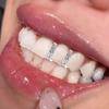 3/5Pcs Funny Rhinestone Teeth Caps Punk Single Dental Braces Hip Hop Teeth Grillz  Rapper