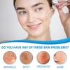 30mlAnti Aging Liquid, Deep Wrinkle Liquid,wrinkle Liquid Containing Hyaluronic , Suitable For Brightening All Skin Types