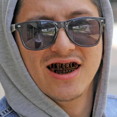 SHOP-STORY - Sada zubů ve stylu Hip Hop Grillz - Černá