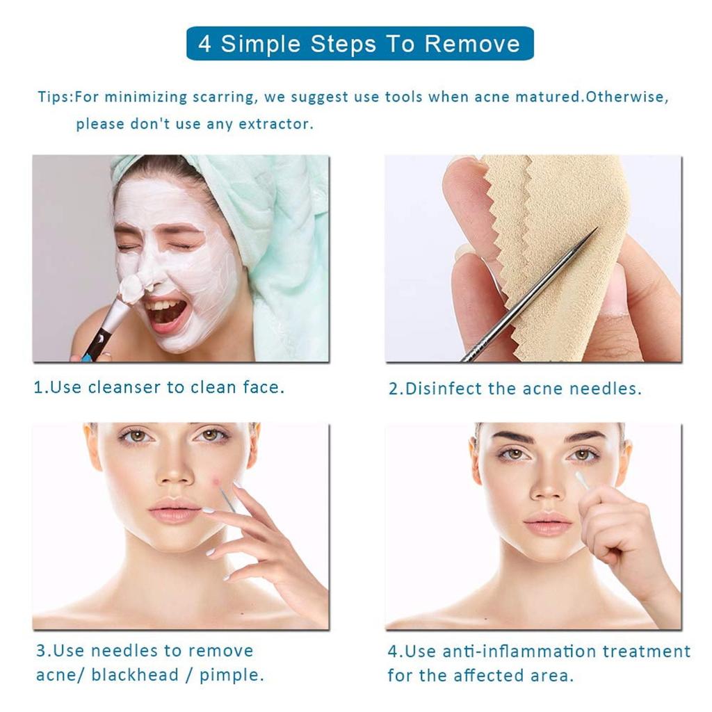 4 Piece Stainless Blackhead Remover Tool Set - Extractor Needle for Facial , Comedone Pusher, Home Kit