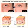 Hyaluronic Acid Anti-Aging Serum Lightens Dark Circles, Wrinkles, Firms and Brightens Skin
