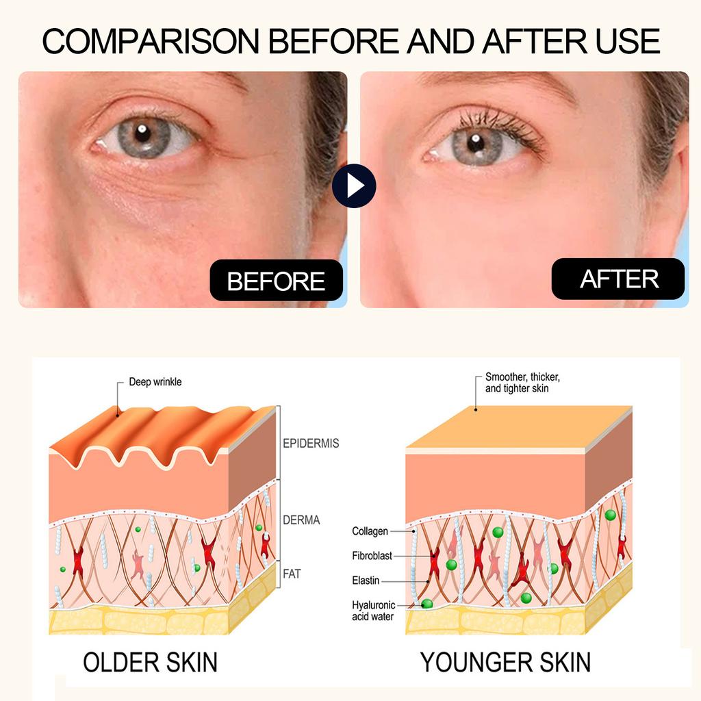 Hyaluronic Acid Anti-Aging Serum Lightens Dark Circles, Wrinkles, Firms and Brightens Skin