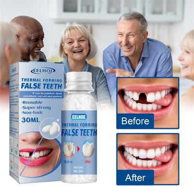 Kit de dientes temporales, dientes y huecos, pegamento sólido para dentadura postiza, adhesivo para blanquear los dientes, herramienta de belleza dental