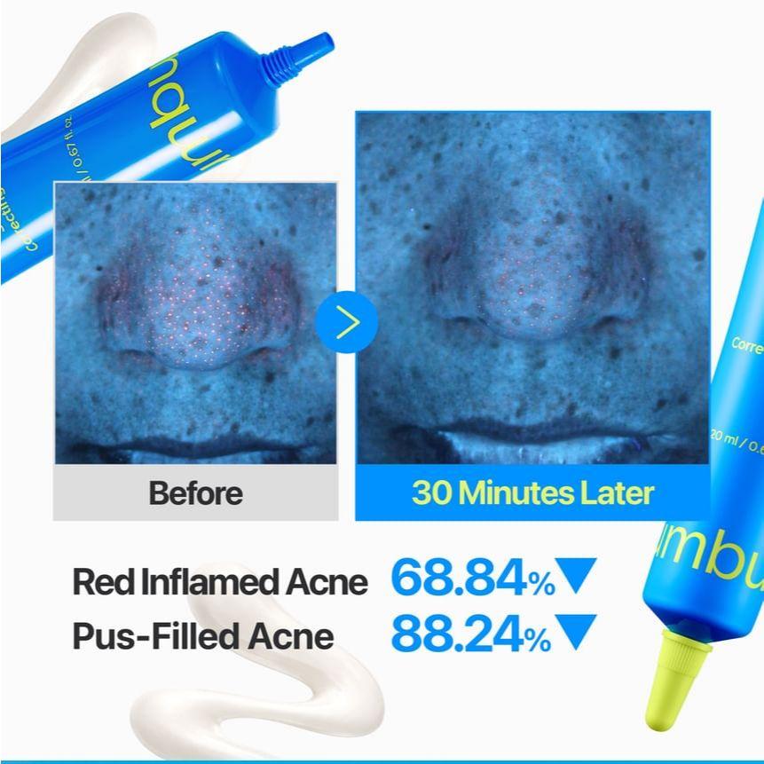 [NEW] Numbuzin Zero Blemish 3X Spot Correcting Cream 20mL