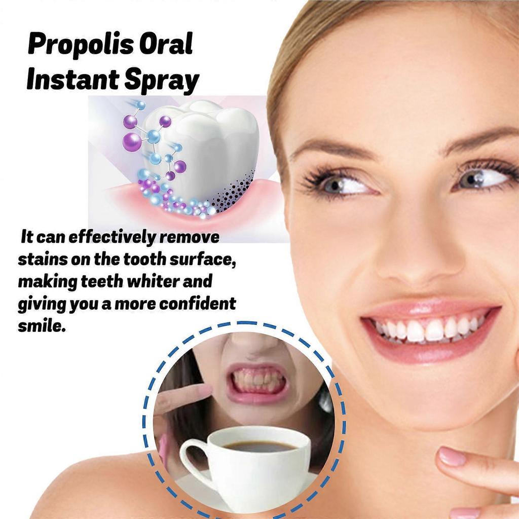 Oralhoe Propolis Oral Care Spray Cleans Stains And Tartar, Eliminates Odors, Freshens Breath And Whitens Teeth