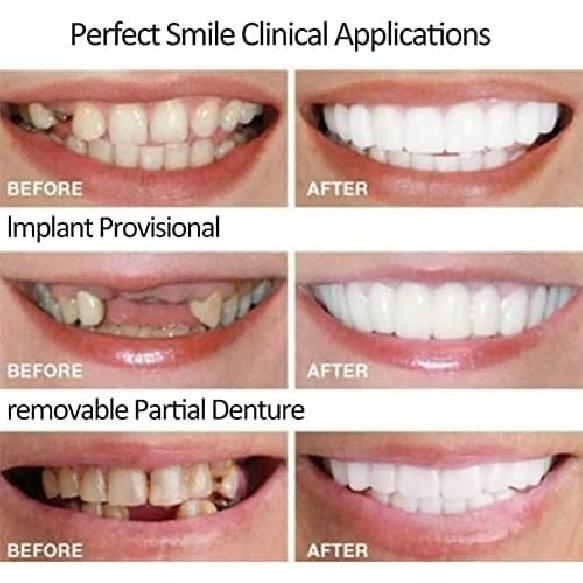 2 Pairs, Beautiful Smile,Nature and Comfortable