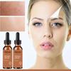 5ML/15ML/30ML/50ML/TRSTAY Effective Whitening Freckle Cream Remove Dark Spot Face Cream Removal  Melasma Lighten Brighten Smooth Skin Care