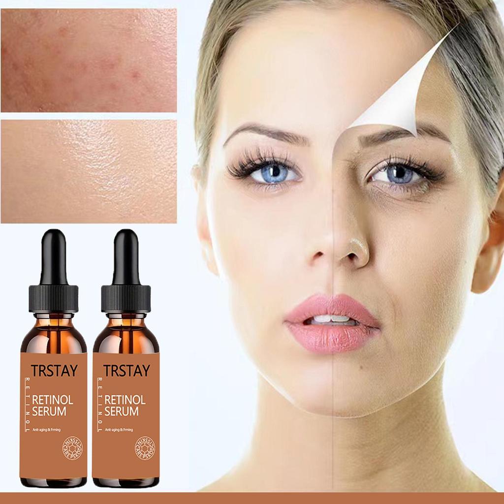 5ML/15ML/30ML/50ML/TRSTAY Effective Whitening Freckle Cream Remove Dark Spot Face Cream Removal  Melasma Lighten Brighten Smooth Skin Care