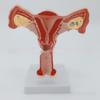 Female Reproductive System Anatomical Model - Uterus and Ovaries