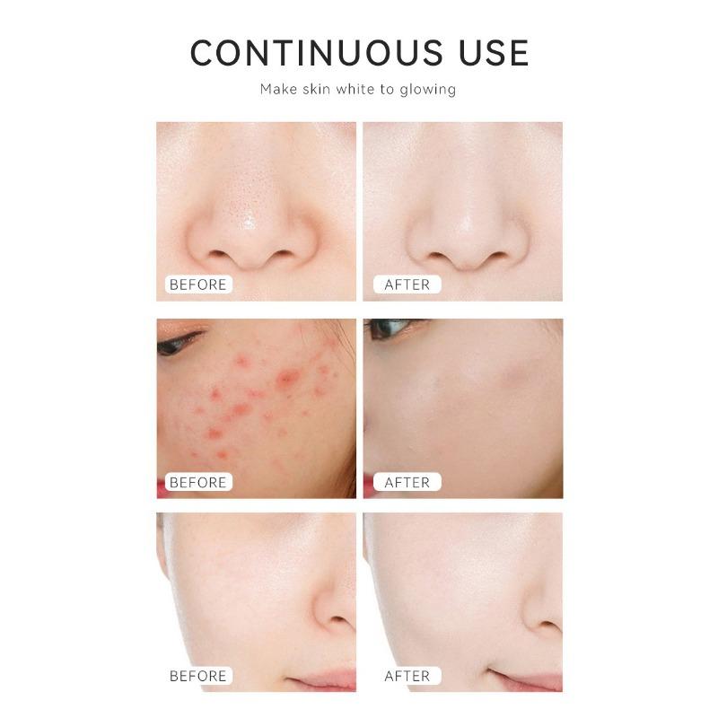 Anti-Wrinkle Compact Liquid Essence Spot Soluble Oil Facial Anti-aging Solution