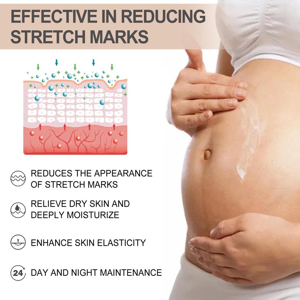 Wiieey Butter Moisturizing Cream Lightens Stretch Marks Repairs Skin Elasticity Firms & Smoothes