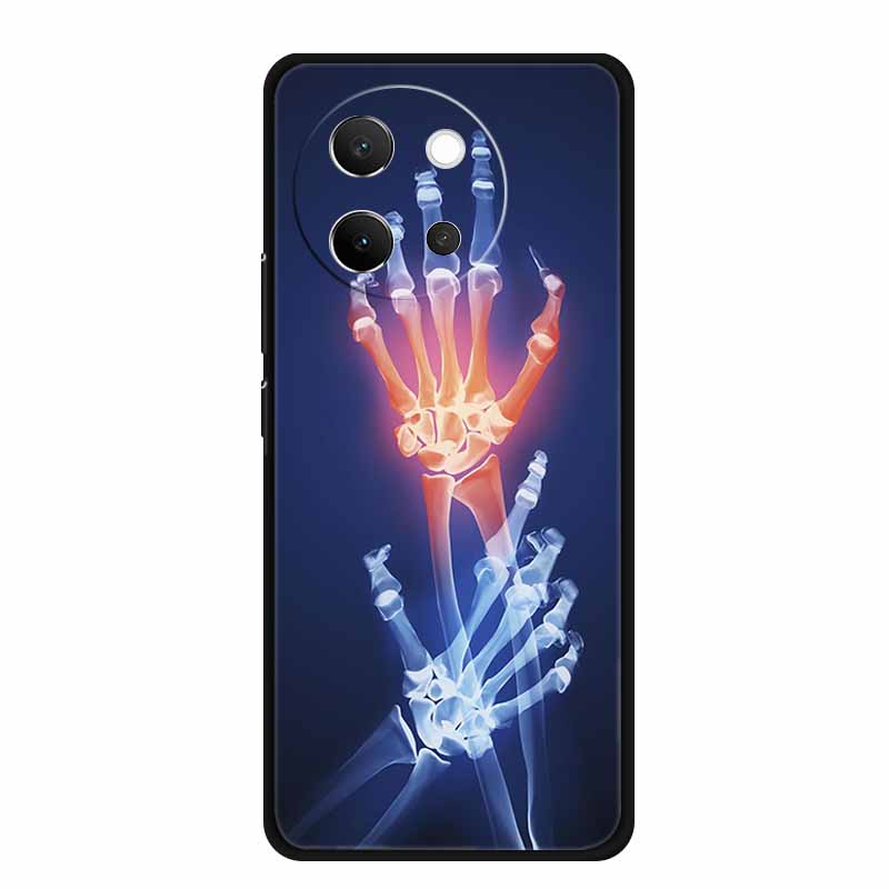 For Vivo V40 Lite Case V40lite V 40 Lite Fashion Black Silicone Soft Back Cover Case For Vivo V30e 5G Phone Case V 30 e Funda
