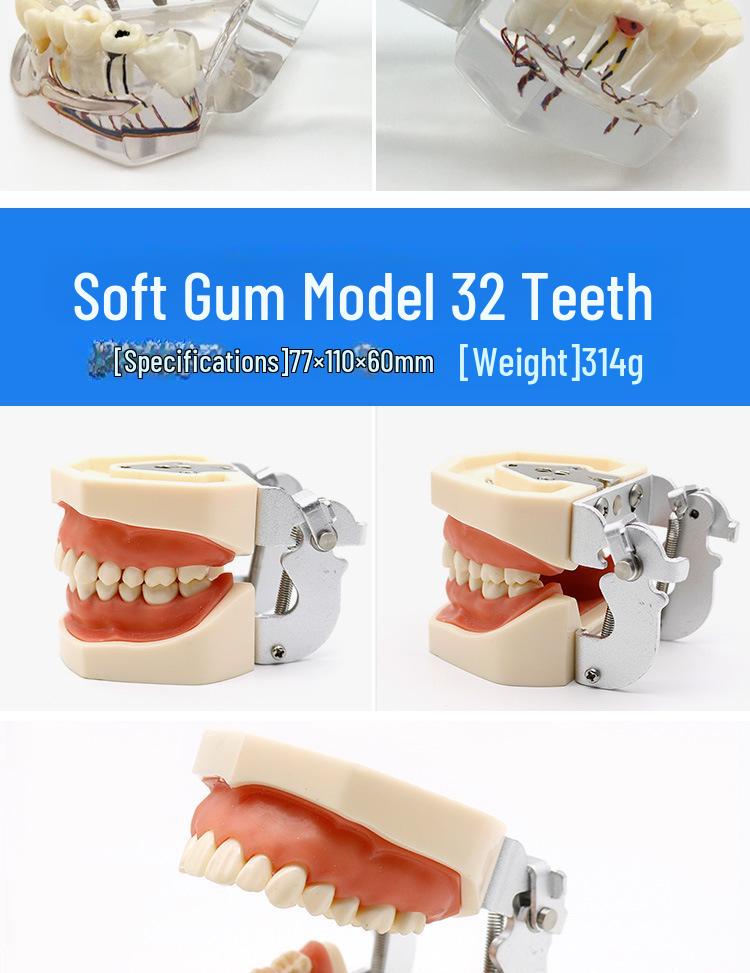 Dental Educational and Communication Model Set: Comprehensive, Removable, and Implant Restoration Models