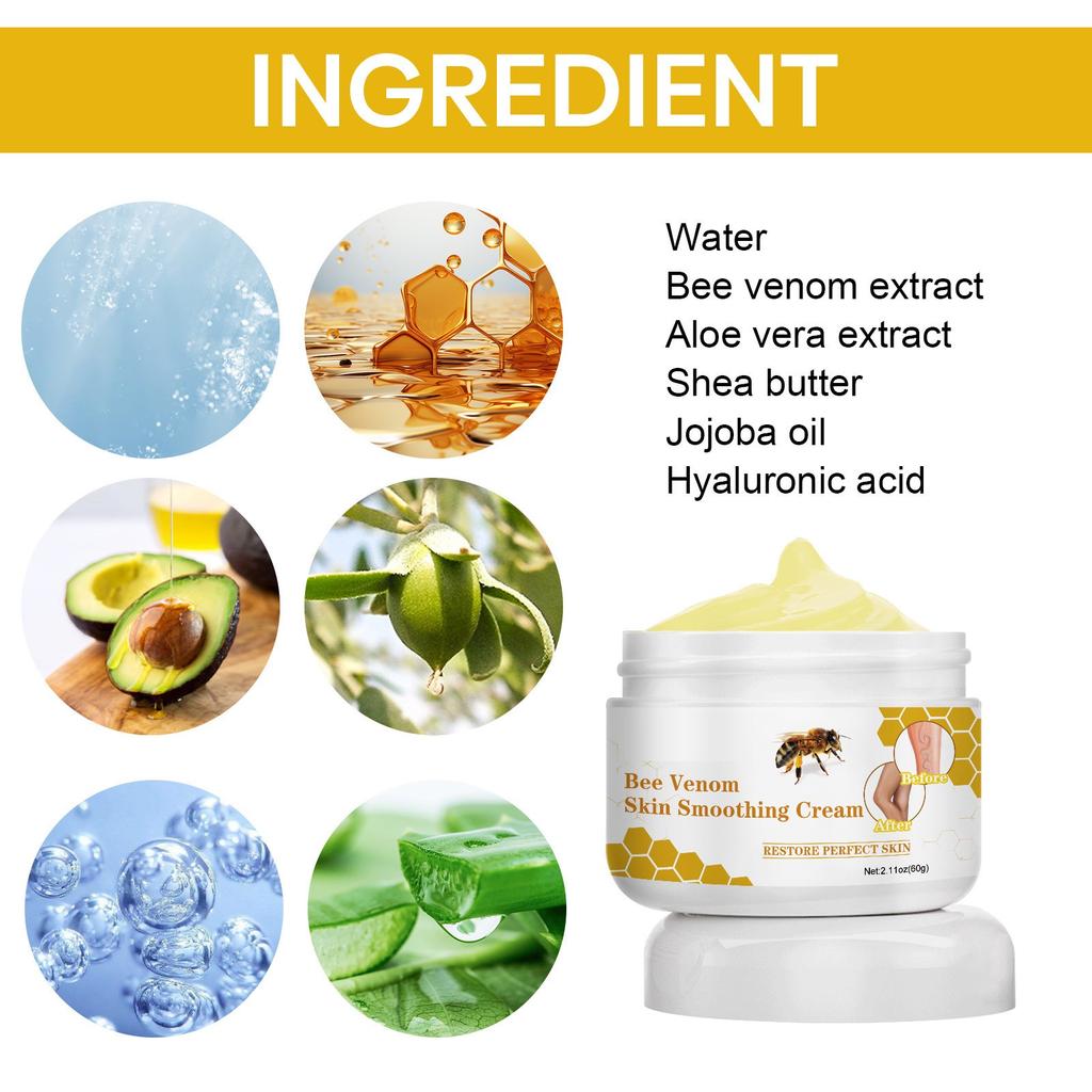 Varicose Veins, Varicose Veins, Pain Ointment, Varicose Veins, Varicose Veins