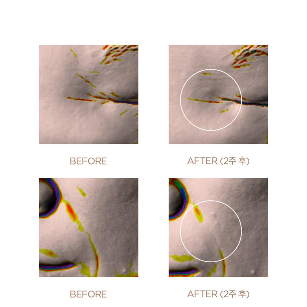 SKIN1004 Madagascar Centella Probio-Cica Bakuchiol Øyekrem - 20ml