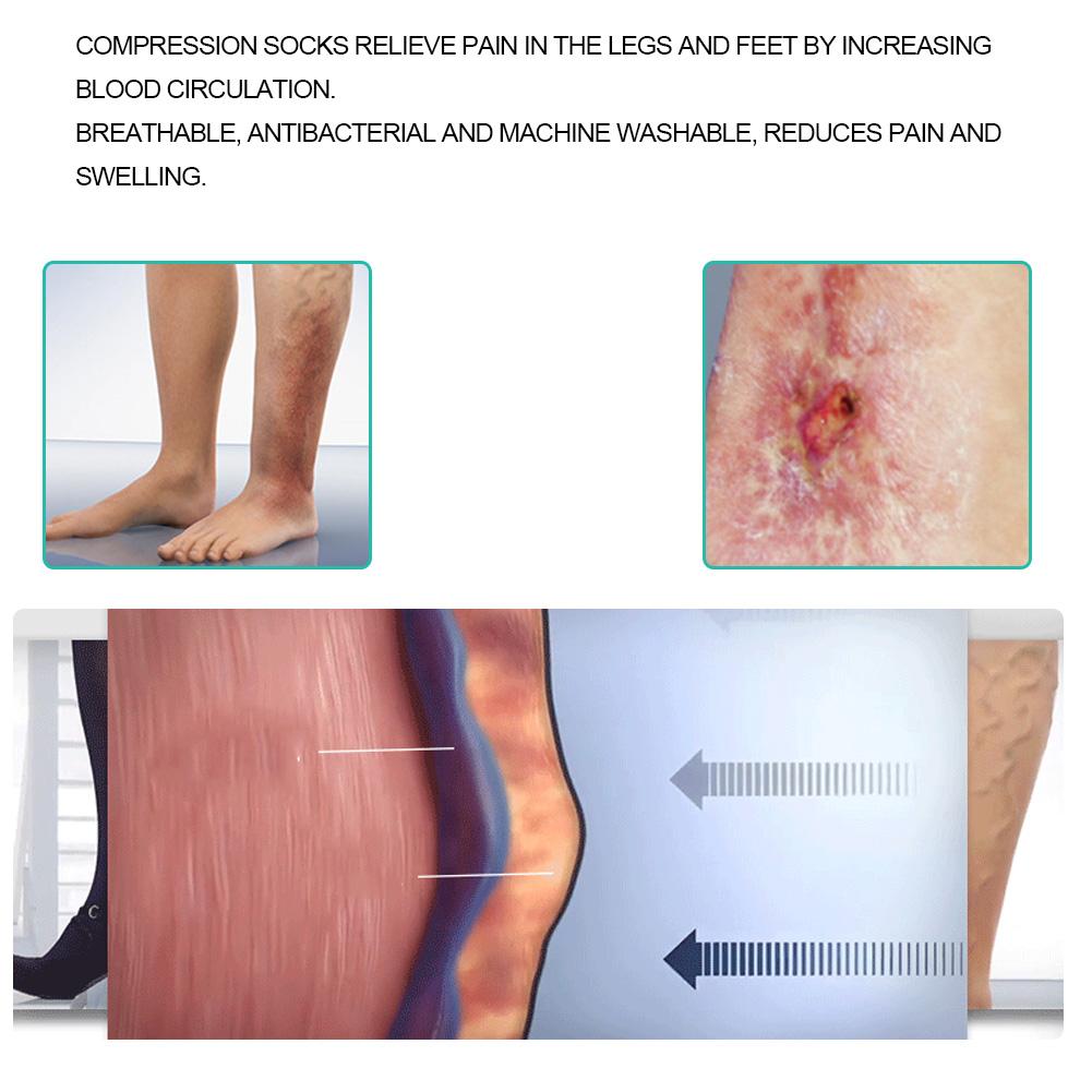 Medical Elastic Compression Stockings Varicose Veins Stockings Leg Slimming