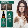 Huile capillaire Soin du cuir chevelu - Nettoyage en profondeur et réparation pour les racines des cheveux, Soulage Nouveau produit S06