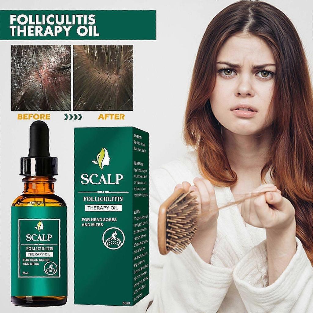 Huile capillaire Soin du cuir chevelu - Nettoyage en profondeur et réparation pour les racines des cheveux, Soulage Nouveau produit S06