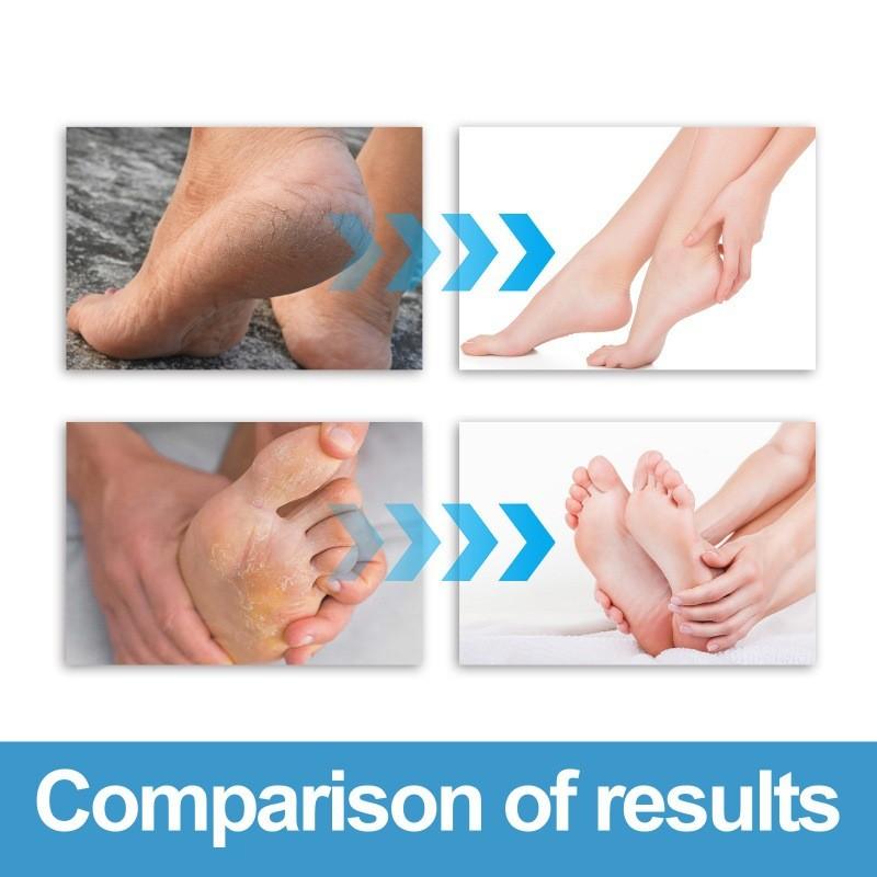 Nourishing West Month Foot Care Cream For Moisturizing Cracked Heels And Rough Skin