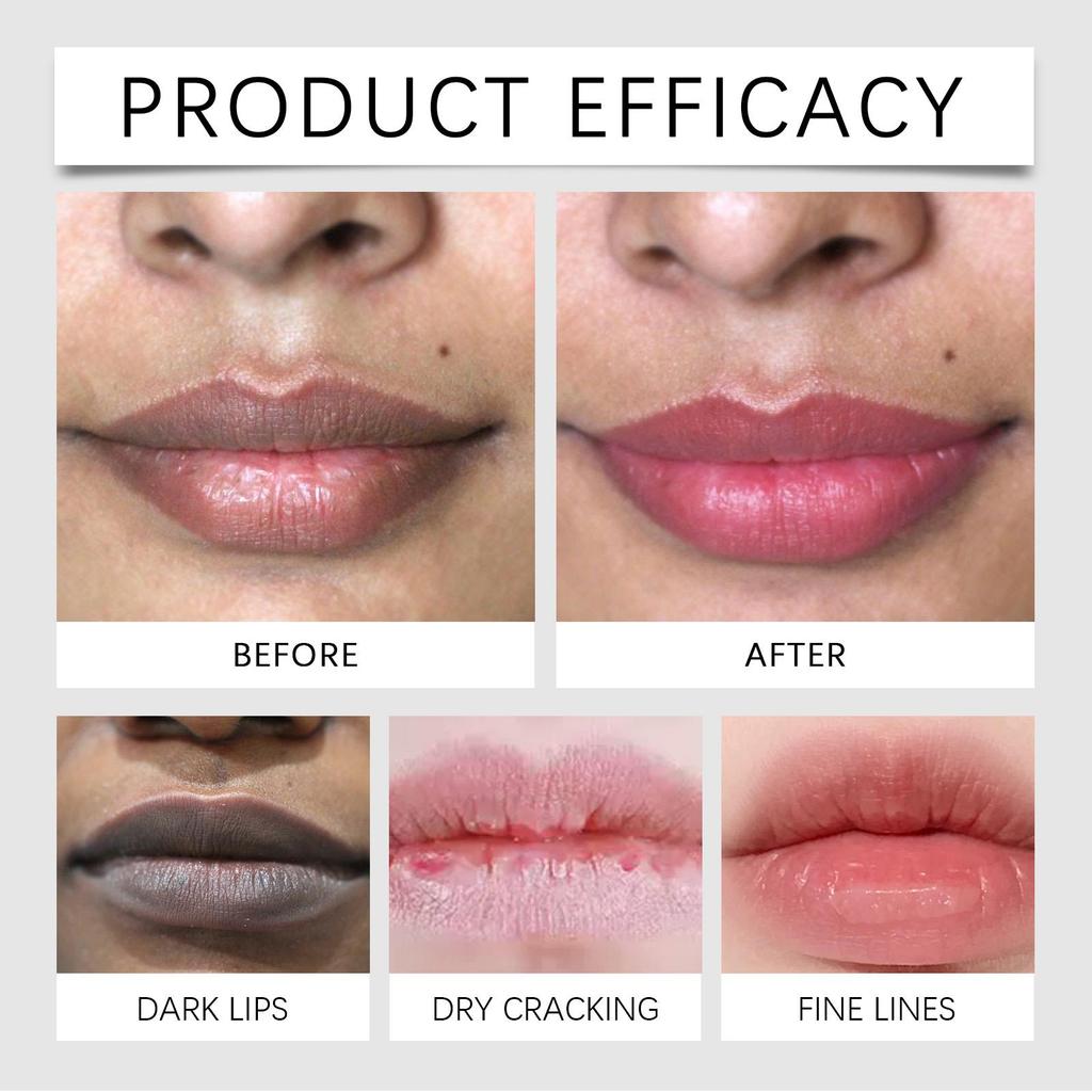 OUHOE Lip Brightening Balm 10ml Natural Ingredients for Long-lasting Hydration, Brightens Lip Color and Provides Antioxidant Protection