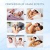 Ximonth Anti Snoring Nasal Clip For Enhanced Breathing And Comfortable Sleep Aid