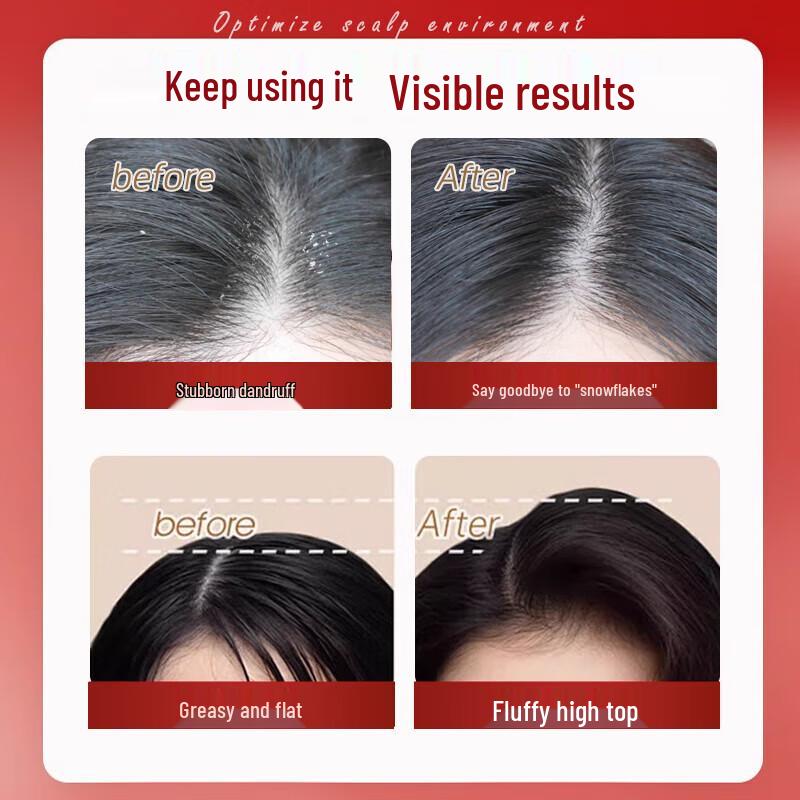 Miss Lilly Anti-Dandruff Refreshing Shampoo