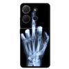 Cover For TCL 503 TPU Silicone Phone Case Flower Blossoms Para Capa Bumper Funda TCL503 Soft Protector Fashion Shockproof Bumper