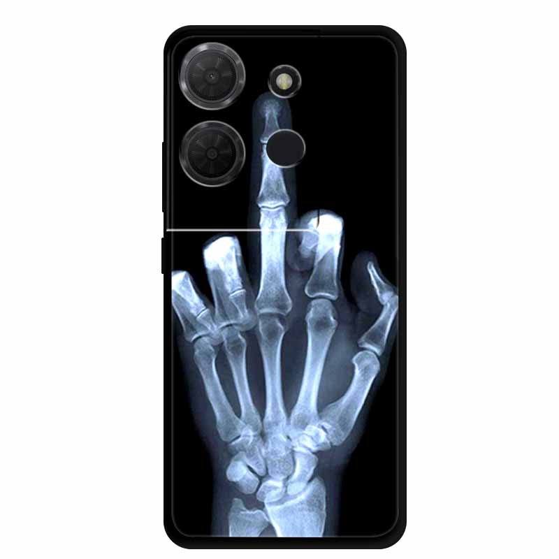 Cover For TCL 503 TPU Silicone Phone Case Flower Blossoms Para Capa Bumper Funda TCL503 Soft Protector Fashion Shockproof Bumper