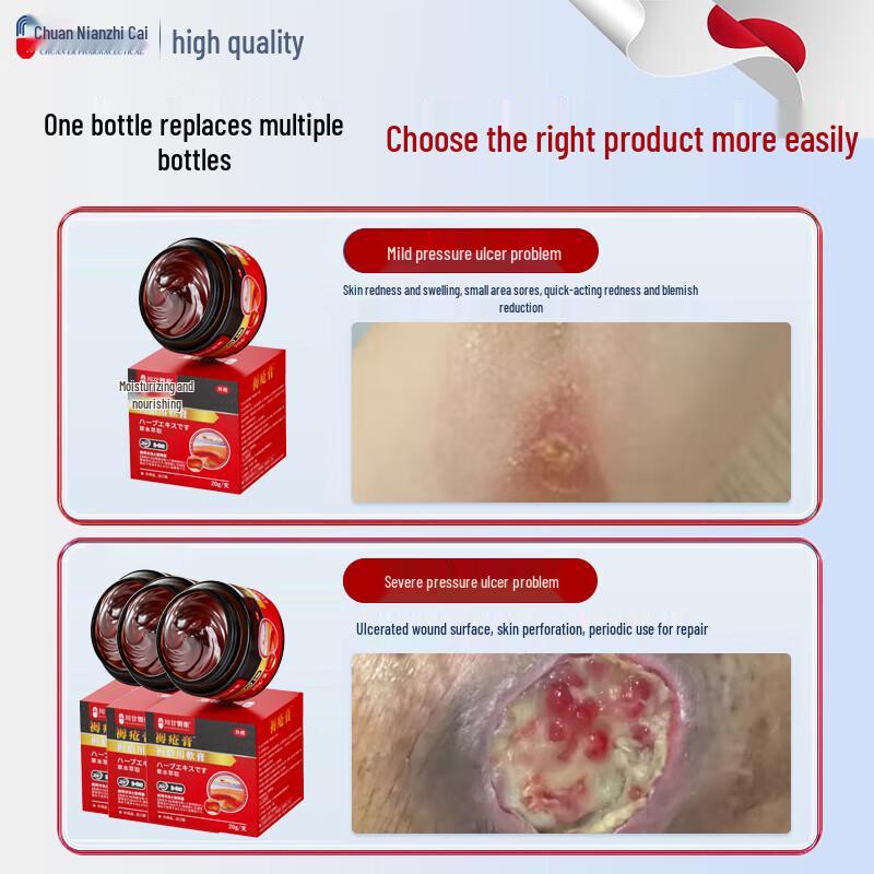Chuan Nian Bedsore & Pressure Ulcer Healing Cream