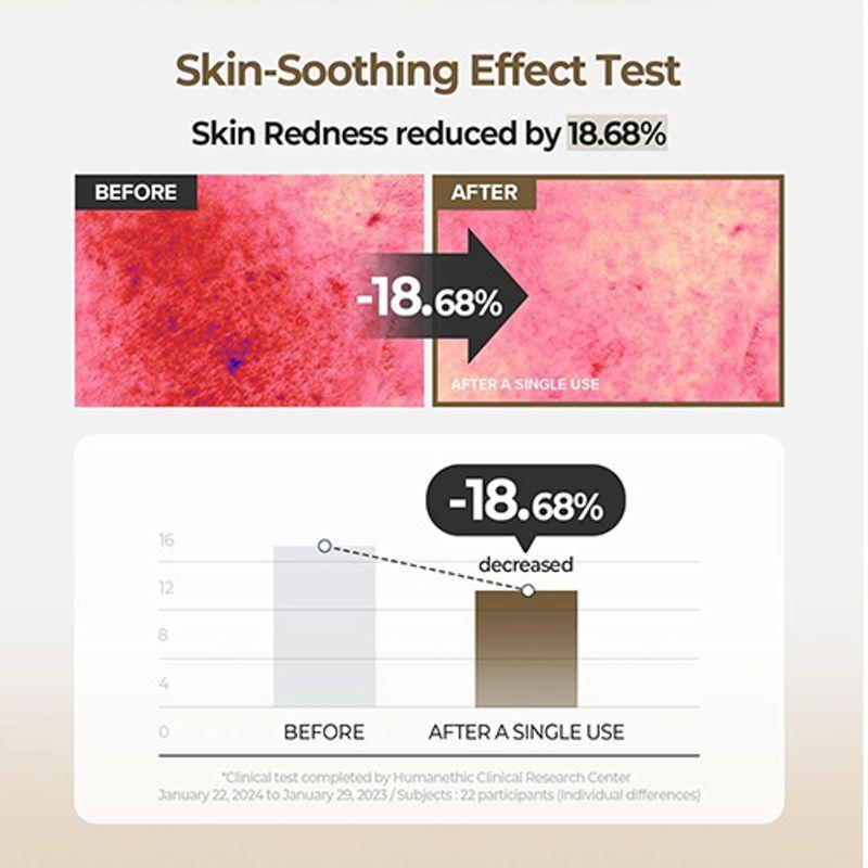 Skinfood Beruhigendes Pad mit Kartoffel-Madecassoside (60ea)