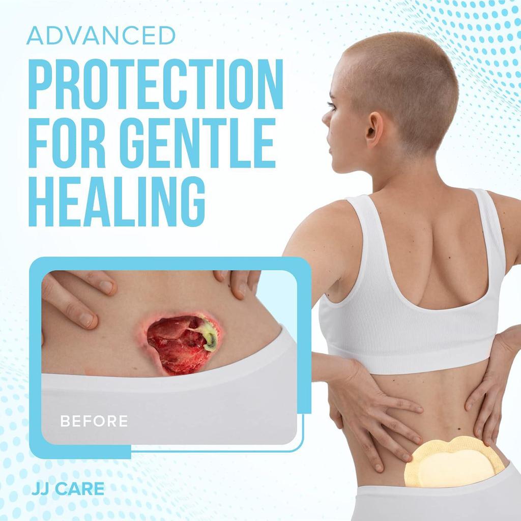Silicone Gel Foam Dressing for Pressure Ulcer Care - Sterile Polyurethane Foam Patch